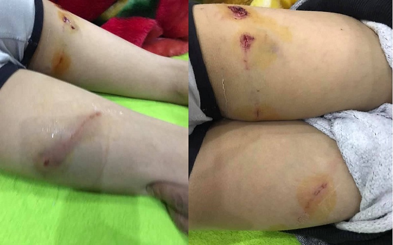 فيديو وصور.. لحظة هجوم كلبي حراسة على طفل بـ