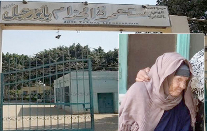 مرضي الجذام منسيون وخارج حسابات الحكومة .. ومستعمرة أبو زعبل تستحق تبرعاتكم