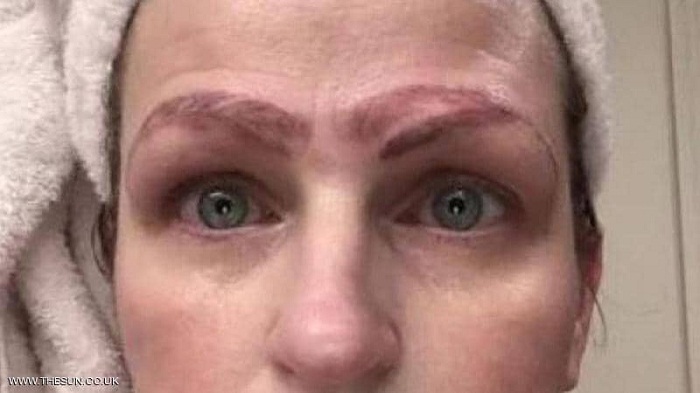 ولدت بدون حواجب، فخضعت لعملية تجميل لتخرج بـ4 حواجب