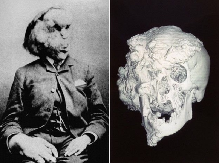 بالصور، بعد 103سنة من وفاته، العثور على قبر 