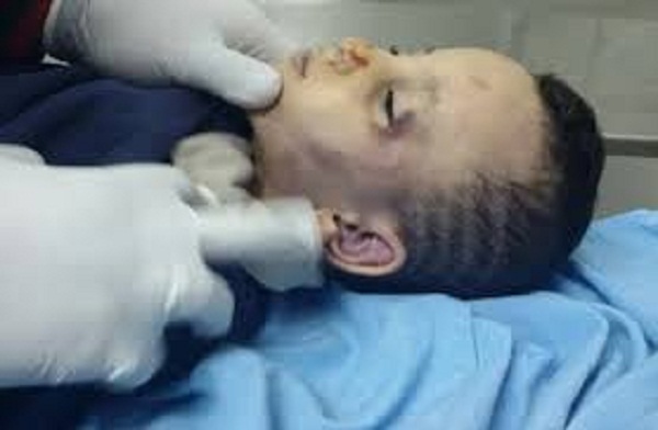 إحالة سائق عذب طفل زوجته حتى الموت للجنايات