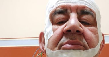 إيهاب فهمى يطمئن الجمهور على إصابة محمد التاجى 
