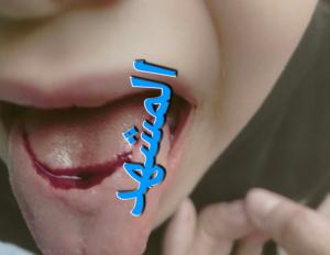 إصابة طفلة KG1 بقطع في اللسان داخل مدرسة خاصة بميت رهينة.. ومحضر رسمي يتهم الإدارة بالإهمال

