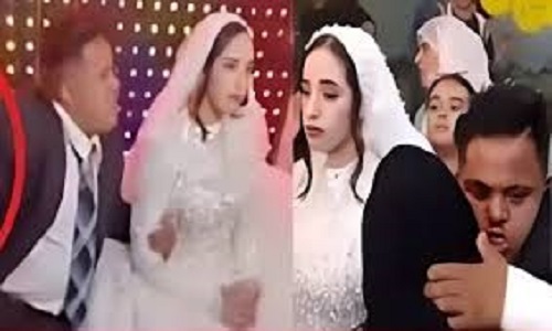 النيابة العامة تتدخل لكشف ملابسات زفاف مصاب بمتلازمة داون
